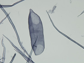Mikroskopische Aufnahme von einem Gefäßelement der Gattung Betula mit charakteristischer Tüpfelung der Gefäßwand. Foto:TI-HF

